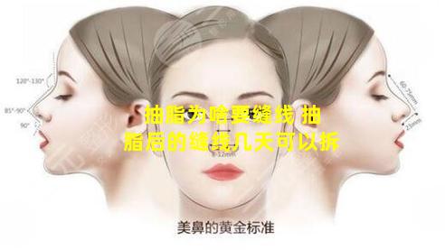 抽脂为啥要缝线 抽脂后的缝线几天可以拆
